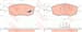 FREN BALATASI ON (151 MM) FIAT LINEA PALIO SIENA 98- DOBLO 02-